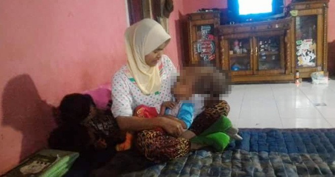 Bocah Penderita Hydrocephalus di Kerinci.